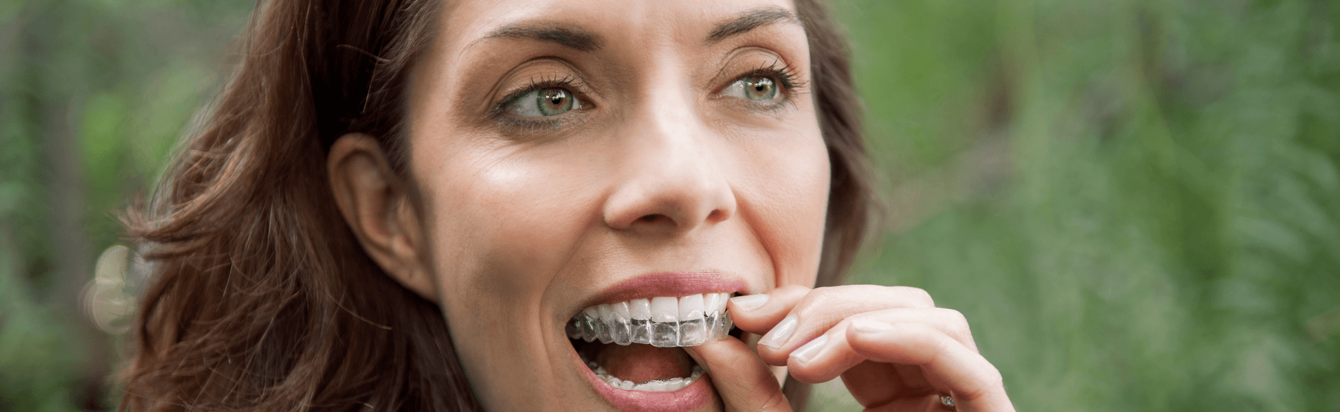 cheap invisalign