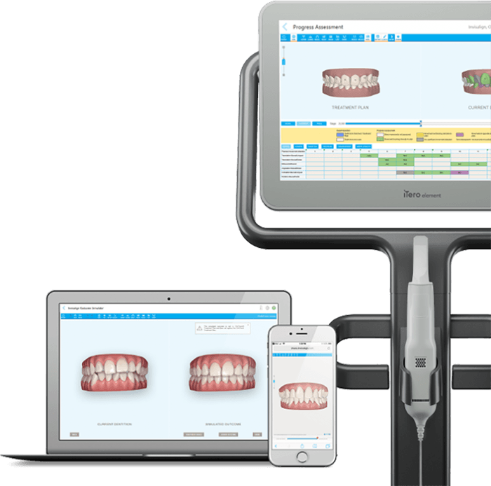 iTero® Scan – Holland Park Dental
