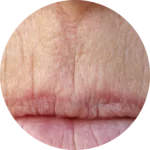 Facial Aestheitcs