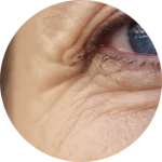 Facial Aesthetics