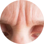 Facial Aesthetics
