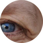Facial Aesthetics