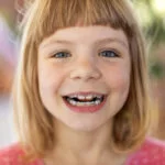 Portrait of smiling little girl with braces Inherit Bad Teeth
