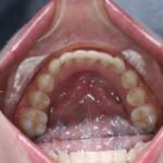 Early Orthodontic Assessment