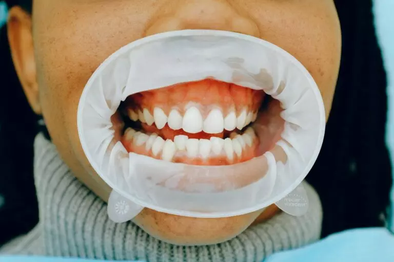 Patient receiving gum contouring treatment