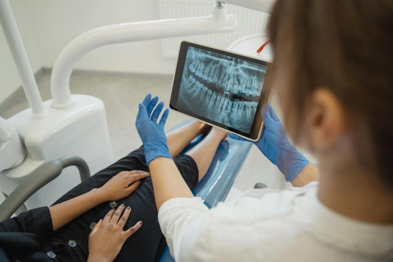 dental-x-rays