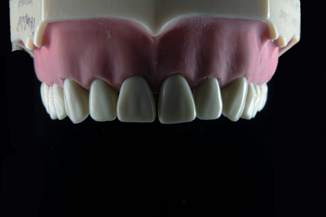 healthy-gums